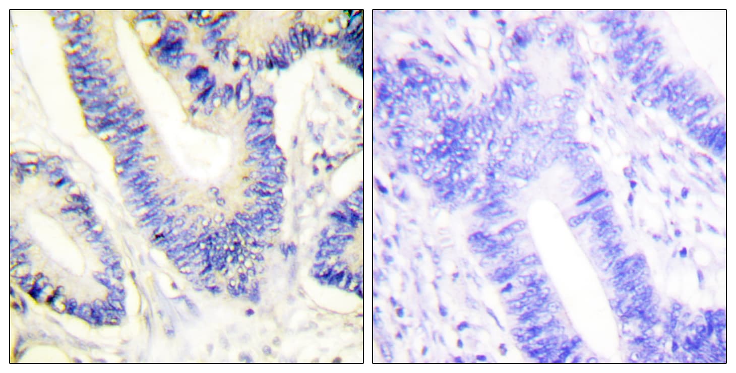 Polyclonal Rabbit anti-Human IRS1 Antibody (aa578-627, IHC)