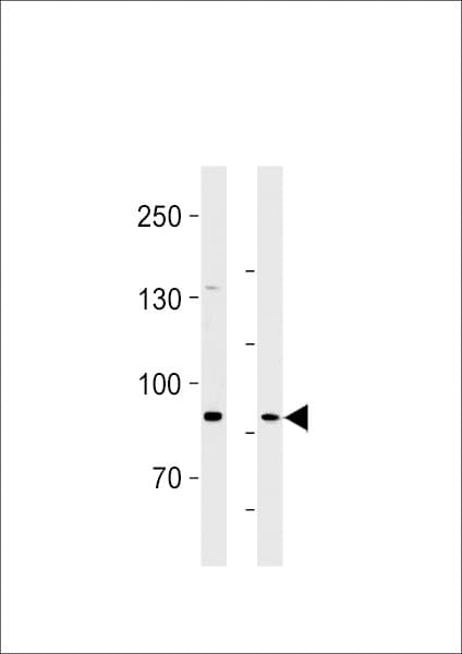 Polyclonal Rabbit anti-Human SEMA6B / Semaphorin 6B Antibody (aa830-859, WB)