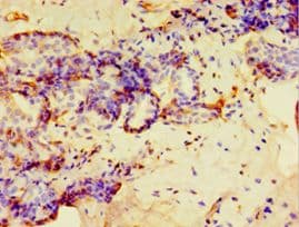Polyclonal Rabbit anti-Human GPS1 / CSN1 Antibody (aa222-491, IHC)