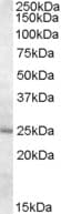 IHC-plus™ HsT19268 / MTHFS Antibody (aa148-160)
