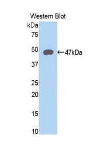LAMP2 / CD107b Antibody (aa193-375)