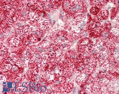 IHC-plus™ GLA / Alpha Galactosidase Antibody (aa150-429)