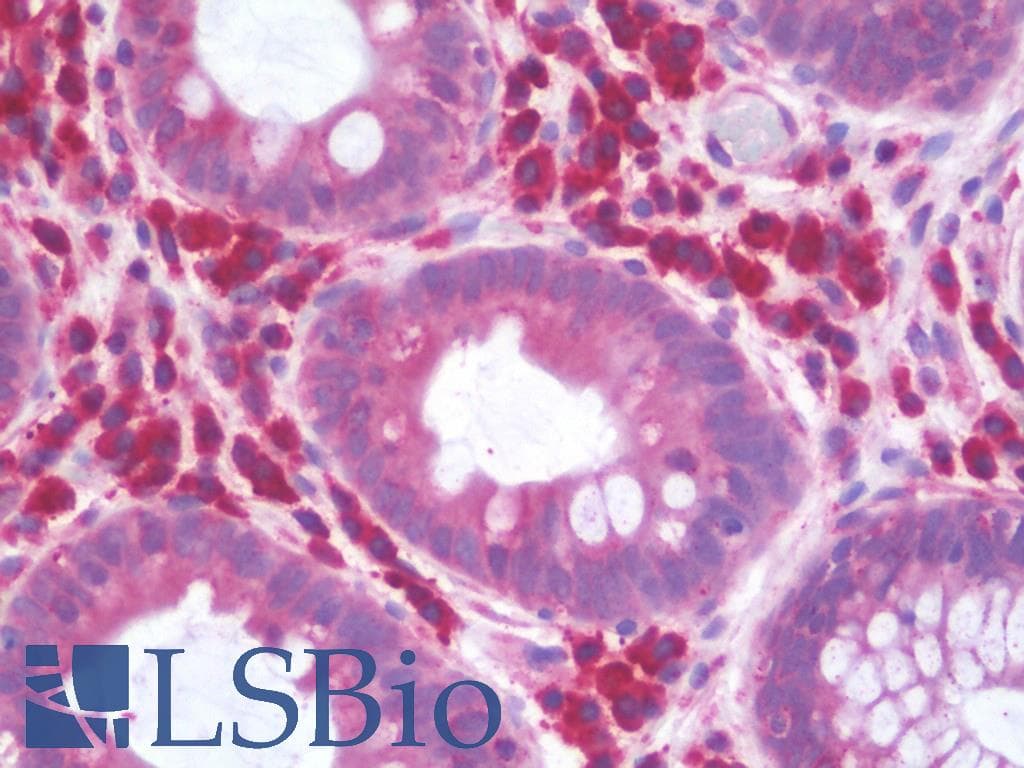 IHC-plus™ Polyclonal Rabbit anti-Human USP42 Antibody (aa251-300, IHC, WB)