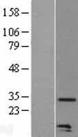 Human CCL20 / MIP-3-Alpha Protein (Over-Expression Lysate Myc-DDK (Flag))