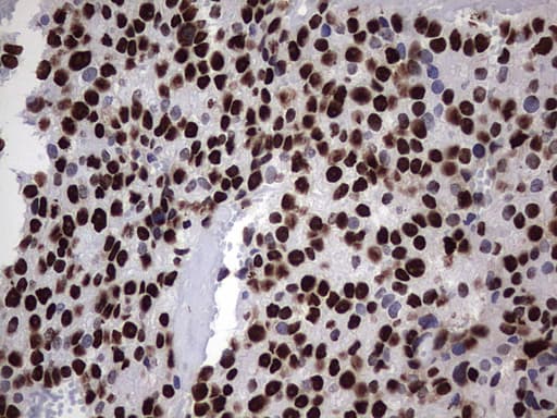 HNRPM / HNRNPM Antibody (aa1-261, clone OTI4C9)