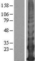 KRTAP12-4 Protein (Over-Expression Lysate Myc-DDK (Flag))