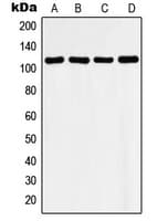 Polyclonal Rabbit anti-Human HDAC9 Antibody (C-Terminus, IHC, IF, WB)
