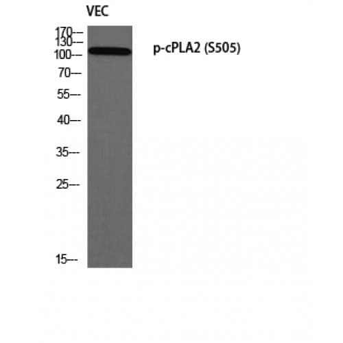 cPLA2 Antibody (440-520 aa)