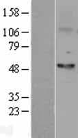 FSCN1 / Fascin Protein (Over-Expression Lysate Myc-DDK (Flag))