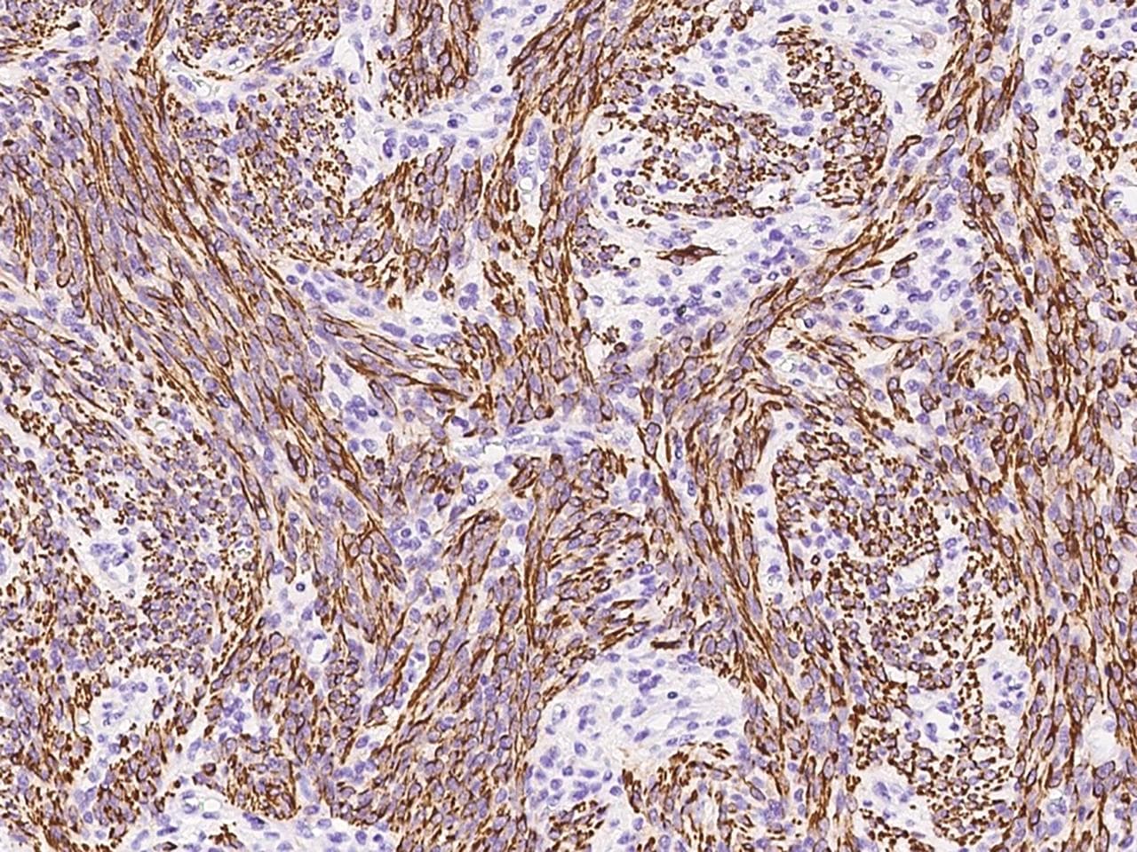 DES / Desmin Antibody (Preservative Free)