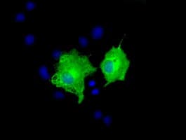 Monoclonal Mouse anti-Human AK5 / Adenylate Kinase 5 Antibody (clone OTI1D5, IF, WB)