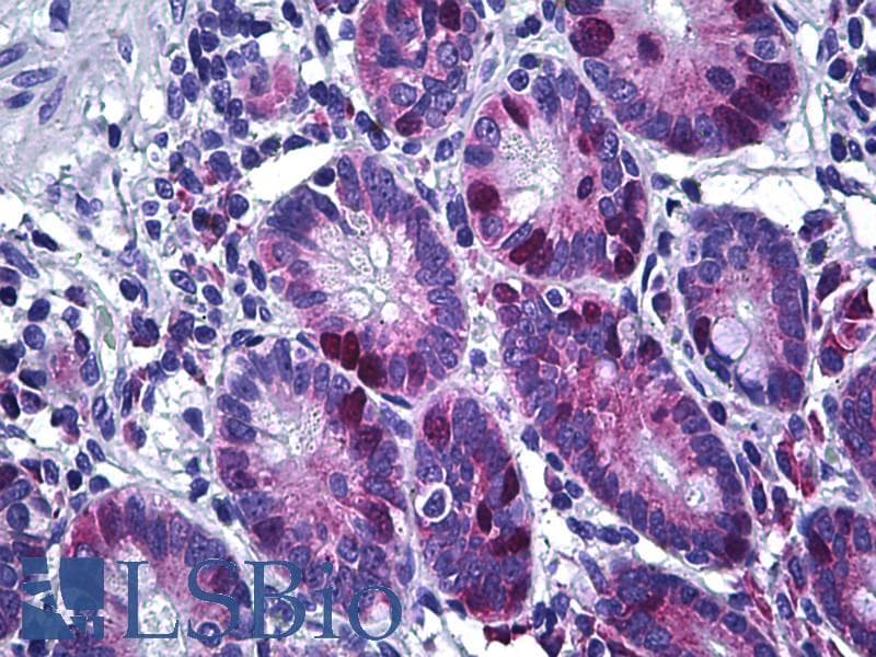 IHC-plus™ Monoclonal Mouse anti-Human HSET / KIFC1 Antibody (clone 2B9, IHC, IF, WB)