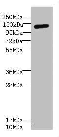 Polyclonal Rabbit anti-Human ITGAX / CD11c Antibody (IHC, IF, WB)
