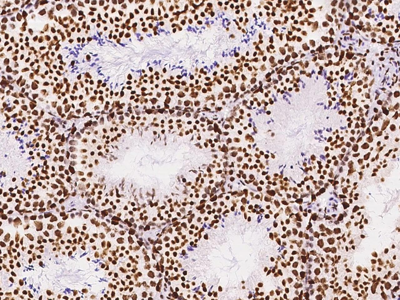 Polyclonal Rabbit anti-Human KLF7 Antibody (IHC)