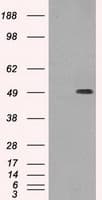 TUBB3 / Tubulin Beta 3 Antibody (clone OTI5H2)