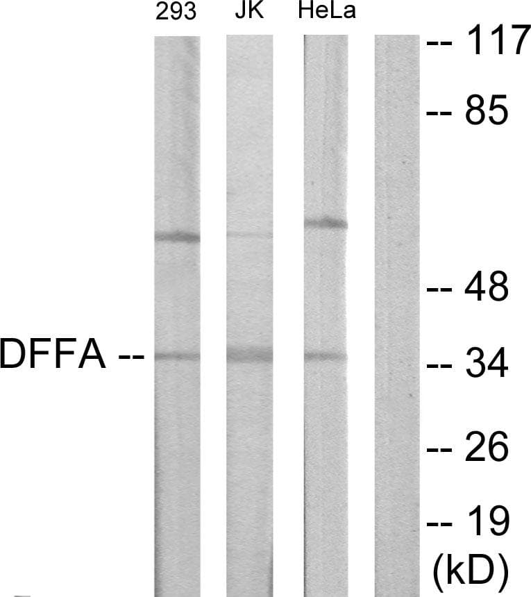 DFFA / ICAD / DFF45 Antibody