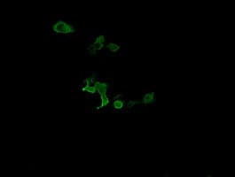 CATIP / C2orf62 Antibody (clone OTI4B4)