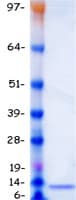 Human GUCA2B / Uroguanylin Protein (Recombinant Myc-DDK (Flag))