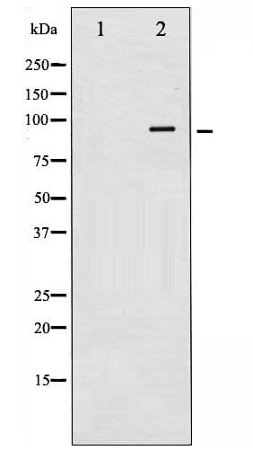 Polyclonal Rabbit anti-Human NR3C1/Glucocorticoid Receptor Antibody (phospho-Ser211, IHC, WB)