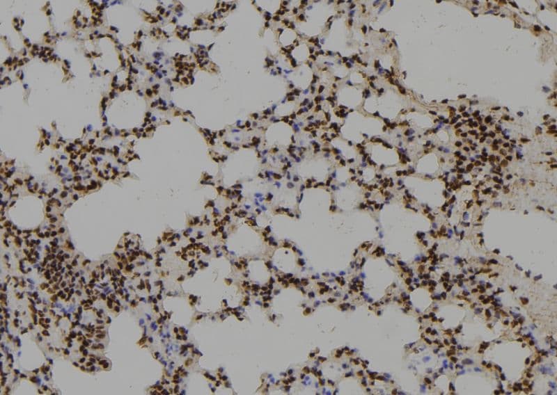 RGS17 / RGSZ2 Antibody
