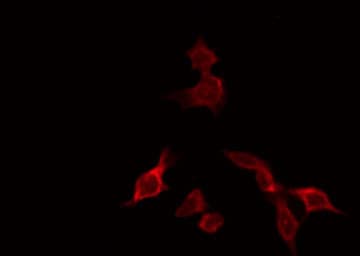 Polyclonal Rabbit anti-Human NXF1 / TAP Antibody (IF, WB)