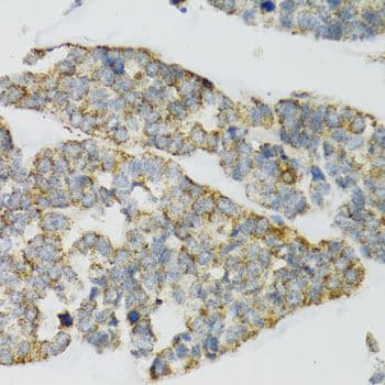 PI3 / Elafin Antibody