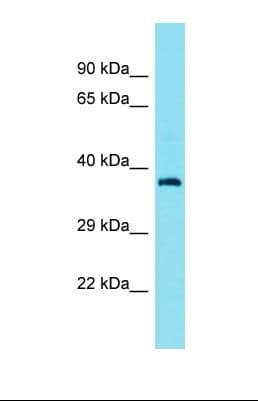 CEP89 Antibody (aa148-197)
