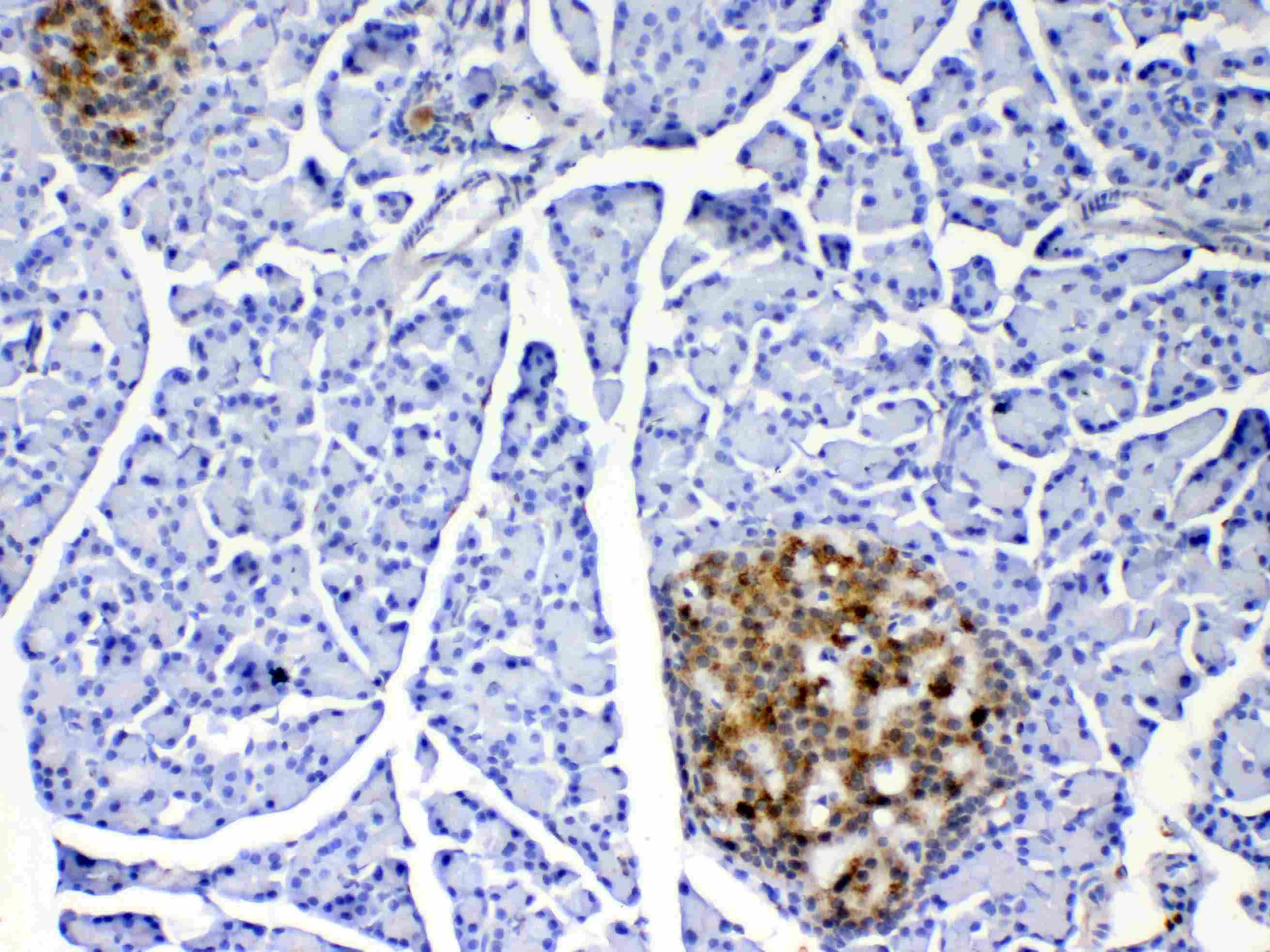 IL17A Antibody