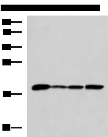 AK5 / Adenylate Kinase 5 Antibody