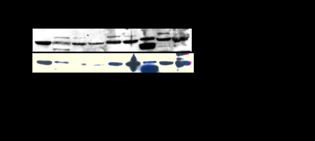 IHC-plus™ Polyclonal Rabbit anti-Human RELA / NFKB p65 Antibody (phospho-Ser529, IHC, WB)