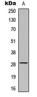 Polyclonal Rabbit anti-Human MtTFA / TFAM Antibody (Internal, IHC, IF, WB)