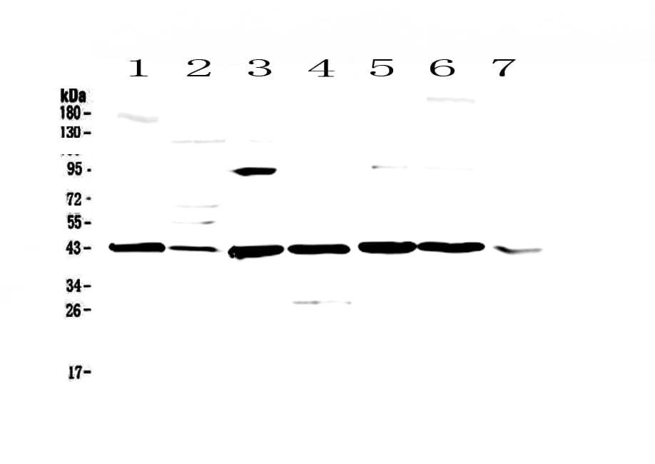 CASP4 / Caspase 4 Antibody