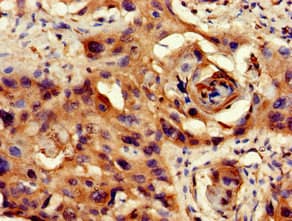 Polyclonal Rabbit anti-Human PPP1CB Antibody (IHC, WB)