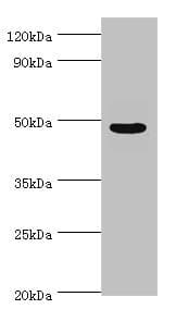 Polyclonal Rabbit anti-Human ECSIT Antibody (aa185-431, IHC, WB)