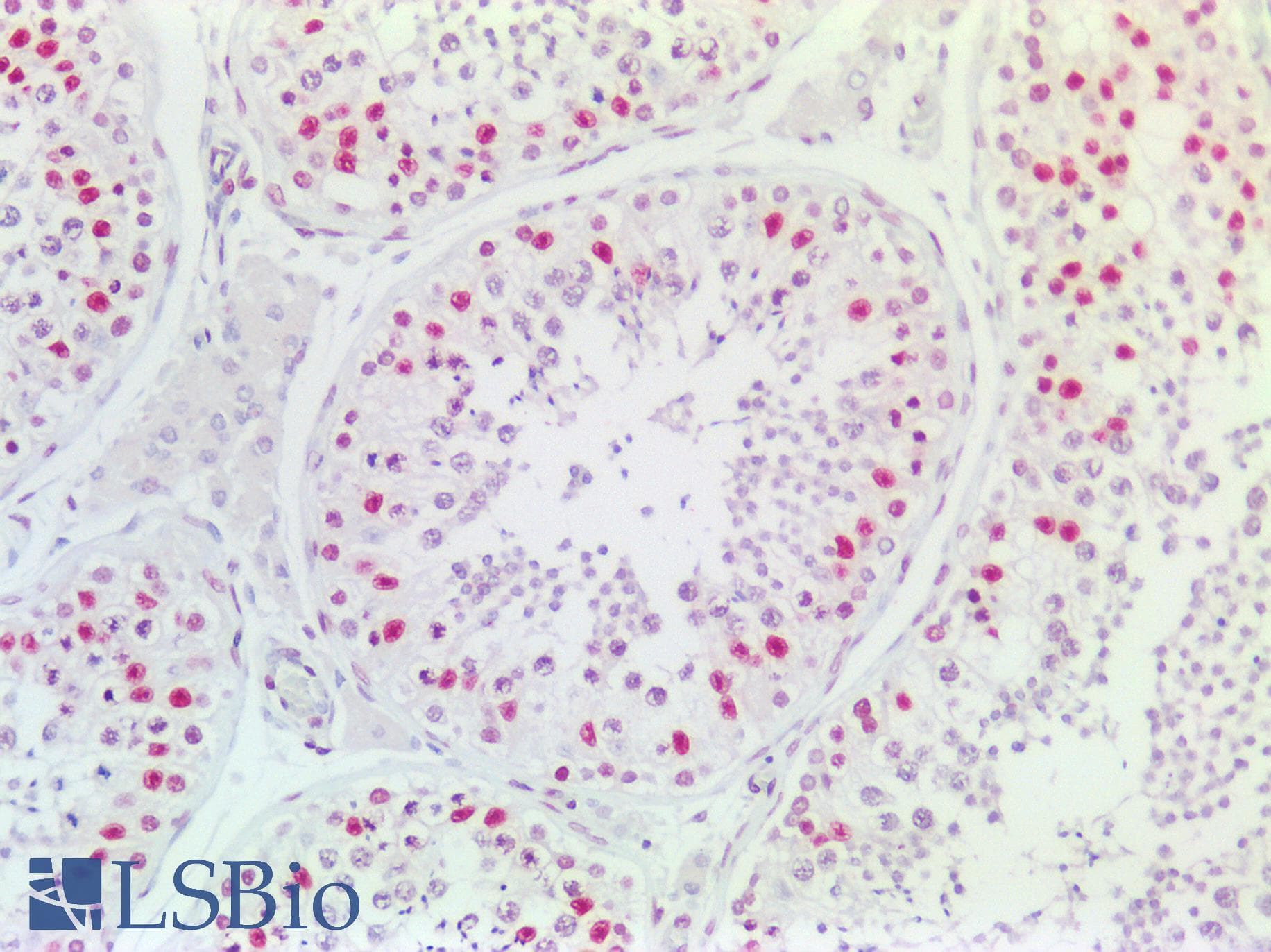 PathPlus™ EP300 / p300 Antibody (aa1-50)