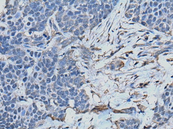 TPT1 / TCTP Antibody