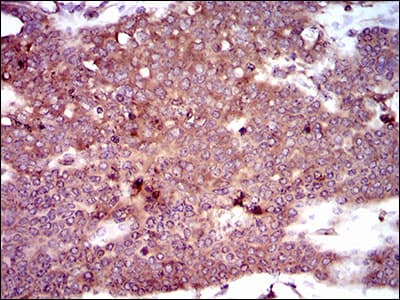 DCTN4 / Dynactin 4 Antibody (aa57-298, clone 3G9D7)