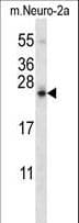 SDF2L1 Antibody (aa160-189)