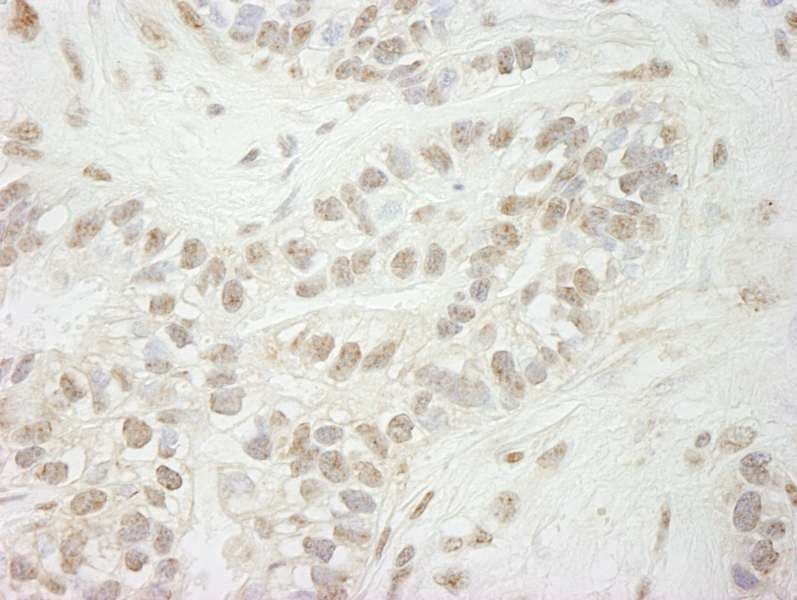 KDM5B / JARID1B Antibody (aa1494-1544)