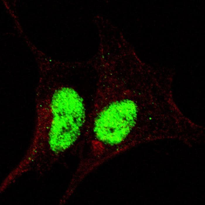 SOX2 Antibody (phospho-Ser246)