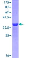 Human MEIS1 Protein (Recombinant GST, N-terminus)