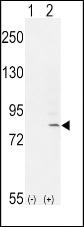 Polyclonal Rabbit anti-Human FGFR1 / FGF Receptor 1 Antibody (aa285-314, WB)