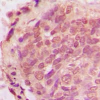 Polyclonal Rabbit anti-Human Ubiquitin Antibody (Internal, IHC, WB)