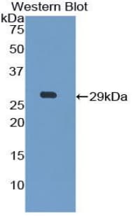 LGALS12 / Galectin 12 Antibody (aa70-291)