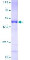 Human CENPN / CENP-N Protein (Recombinant GST)