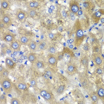 TLK2 Antibody