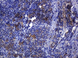 SOAT2 Antibody (clone OTI2D3)