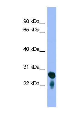 Polyclonal Rabbit anti-Human RAB5C Antibody (C-Terminus, WB)