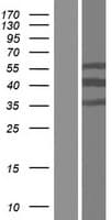 CT47A2 Protein (Over-Expression Lysate Myc-DDK (Flag))