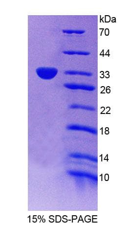 Mouse PLSCR5 Protein (Recombinant His-T7, N-terminus)